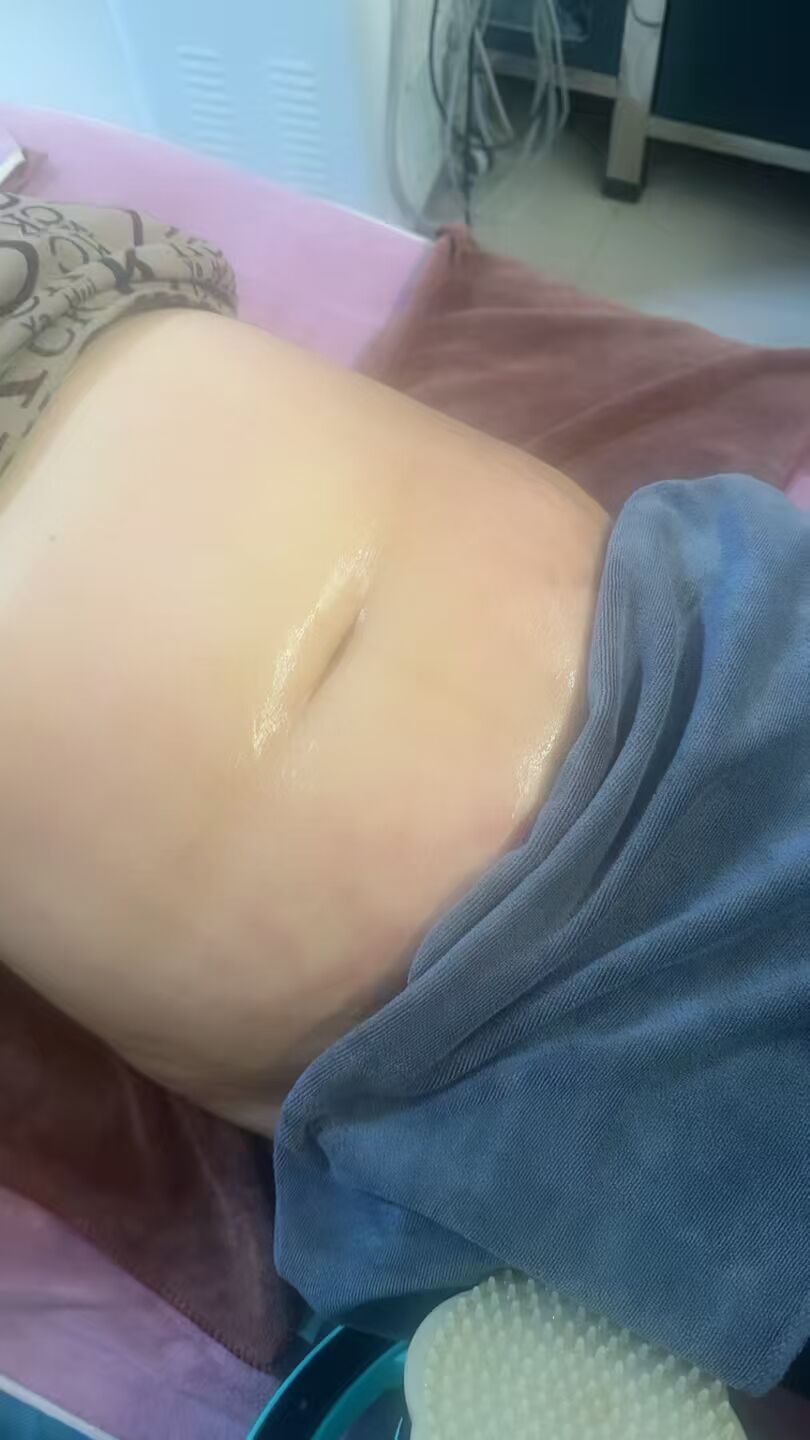 减肥